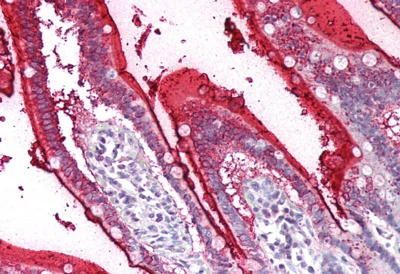 Immunohistochemistry-Paraffin: SI Sucrase-Isomaltase Antibody [NBP3-41422] - Vector Red staining on IHC-P; Samples: Human Small Intestine Tissue; Primary Ab: 10ug/ml NBP3-41422; Second Ab: 2ug/mL HRP-Linked Caprine Anti-Rabbit IgG Polyclonal Antibody