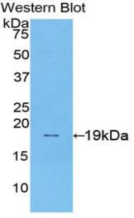 Western Blot: SI Sucrase-Isomaltase Antibody [NBP3-41422] - Sample: Recombinant protein.