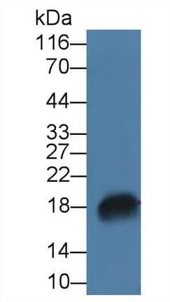 Western Blot: RNASE7 Antibody [NBP3-41424] - Sample: Rat Bone marrow lysate Primary Ab: 2ug/ml NBP3-41424; Second Ab: 0.2ug/mL HRP-Linked Caprine Anti-Rabbit IgG Polyclonal Antibody