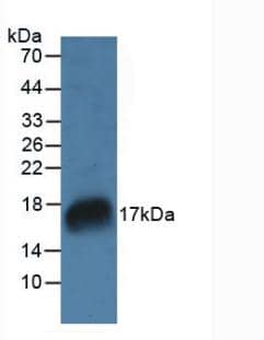 Western Blot: RNASE7 Antibody [NBP3-41424] - Sample: Rat Marrow Tissue.