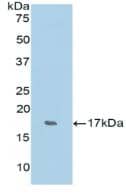 Western Blot: RNASE7 Antibody [NBP3-41424] - Sample: Recombinant RNASE7, Human.