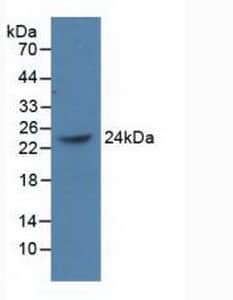 Western Blot: BMI-1 Antibody [NBP3-41429] - Sample: Recombinant BMI-1, Human.