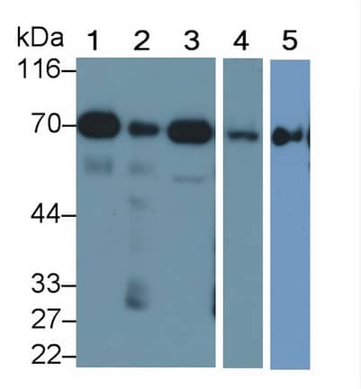 Western Blot: SDHA Antibody (C2) [NBP3-41433] - Sample: Lane1: Mouse Heart lysate; Lane2: Mouse Liver lysate; Lane3: Mouse Cerebrum lysate; Lane4: Mouse Kidney lysate; Lane5: HepG2 cell lysate Primary Ab: 0.1ug/ml NBP3-41433; Second Ab: 0.2ug/mL HRP-Linked Caprine Anti-Mouse IgG Polyclonal Antibody