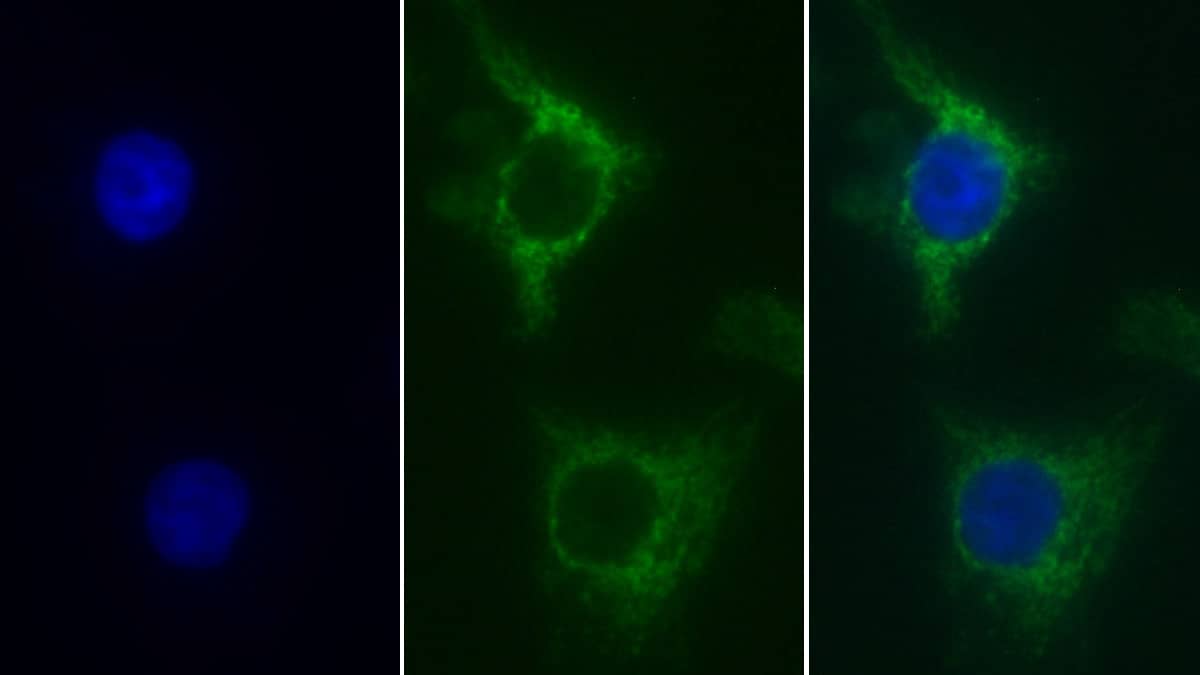 Immunocytochemistry /Immunofluorescence: SDHA Antibody (C2) [NBP3-41433] - FITC staining on IF; Sample: Human Hela cell; Primary Ab: 30ug/ml NBP3-41433; Second Ab: 2ug/ml FITC-Linked Caprine Anti-Mouse IgG Polyclonal Antibody