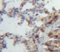 Immunohistochemistry-Paraffin: ADAMTS8 Antibody [NBP3-41435] - Used in DAB staining on fromalin fixed paraffin-embedded Lung tissue
