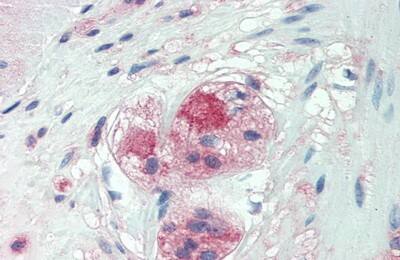 Immunohistochemistry-Paraffin: NG2/MCSP Antibody (6#) [NBP3-41438] - Vector Red staining on IHC-P; Samples: Human Small Intestine Tissue; Primary Ab: 20ug/ml NBP3-41438; Second Ab: 2ug/mL HRP-Linked Caprine Anti-Mouse IgG Monoclonal Antibody