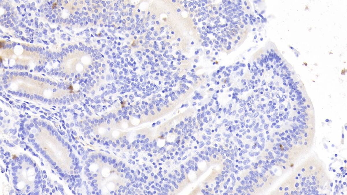 Immunohistochemistry-Paraffin: Neurotensin Antibody (C5) [NBP3-41439] - DAB staining on IHC-P; Sample: Human Small intestine Tissue; Primary Ab: 20ug/ml NBP3-41439; Second Ab: 2ug/mL HRP-Linked Caprine Anti-Mouse IgG Polyclonal Antibody