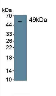 Western Blot: Prosurfactant Protein C Antibody (D3) [NBP3-41441] - Sample: Recombinant SPC, Human.