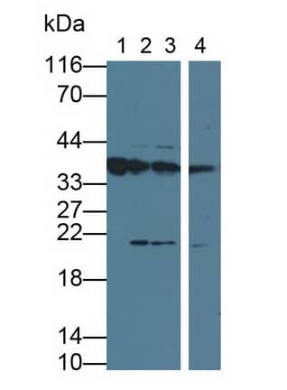 Western Blot Orosomucoid 2 Antibody (D7)