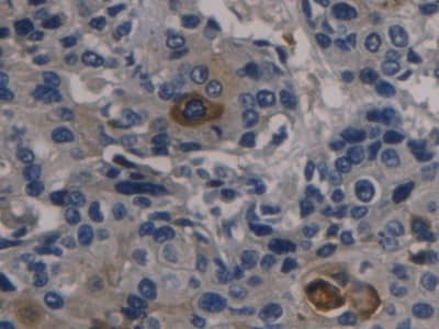 Immunohistochemistry-Paraffin Orosomucoid 2 Antibody (D7)