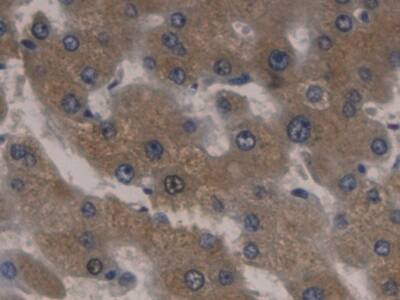 Immunohistochemistry-Paraffin Orosomucoid 2 Antibody (D7)