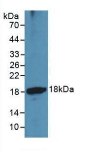 Western Blot: ADAMTS1 Antibody (3#) [NBP3-41448] - Sample: Recombinant ADAMTS1, Human.