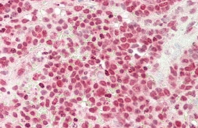 Immunohistochemistry-Paraffin: DNASE1 Antibody (2-1#) [NBP3-41461] - Vector Red staining on IHC-P; Samples: Human Spleen Tissue; Primary Ab: 20ug/ml NBP3-41461; Second Ab: 2ug/mL HRP-Linked Caprine Anti-Mouse IgG Monoclonal Antibody