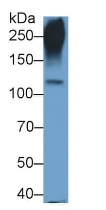 Western Blot: Cadherin-11 Antibody (D3) [NBP3-41463] - Sample: PC3 cell lysate Primary Ab: 1.5ug/ml NBP3-41463; Second Ab: 0.2ug/mL HRP-Linked Caprine Anti-Mouse IgG Polyclonal Antibody