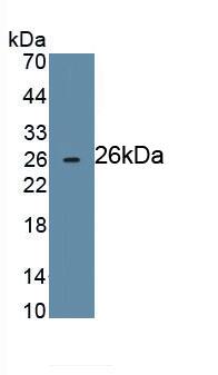 Western Blot: CD72 Antibody (C3) [NBP3-41464] - Recombinant Human CD72