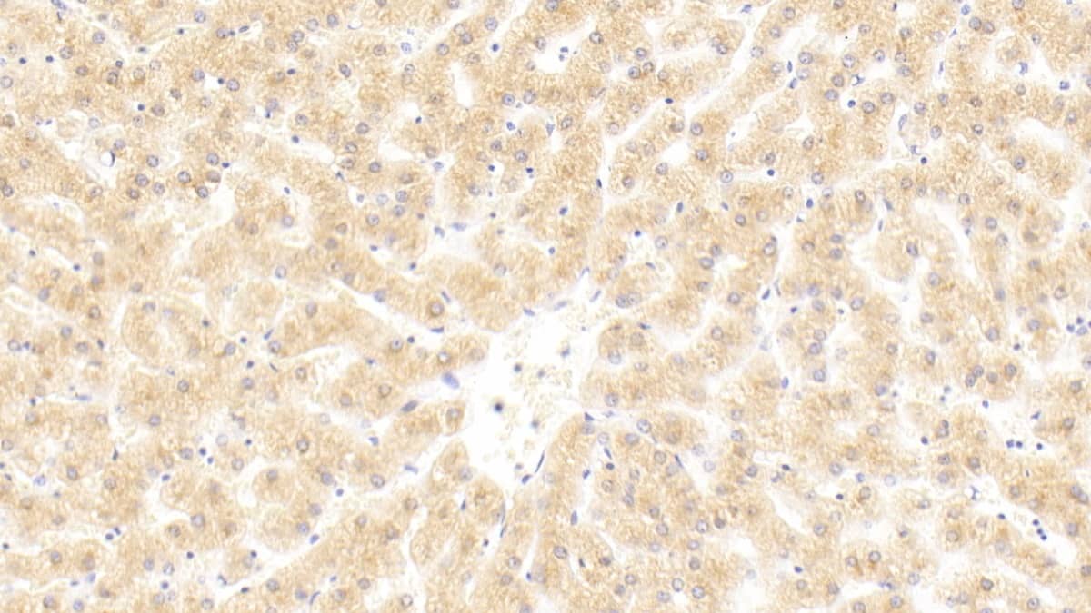 Immunohistochemistry-Paraffin: Complement C4b Antibody (C1) [NBP3-41465] - DAB staining on IHC-P; Samples: Human Liver Tissue; Primary Ab: 30ug/ml NBP3-41465; Second Ab: 2ug/mL HRP-Linked Caprine Anti-Mouse IgG Polyclonal Antibody