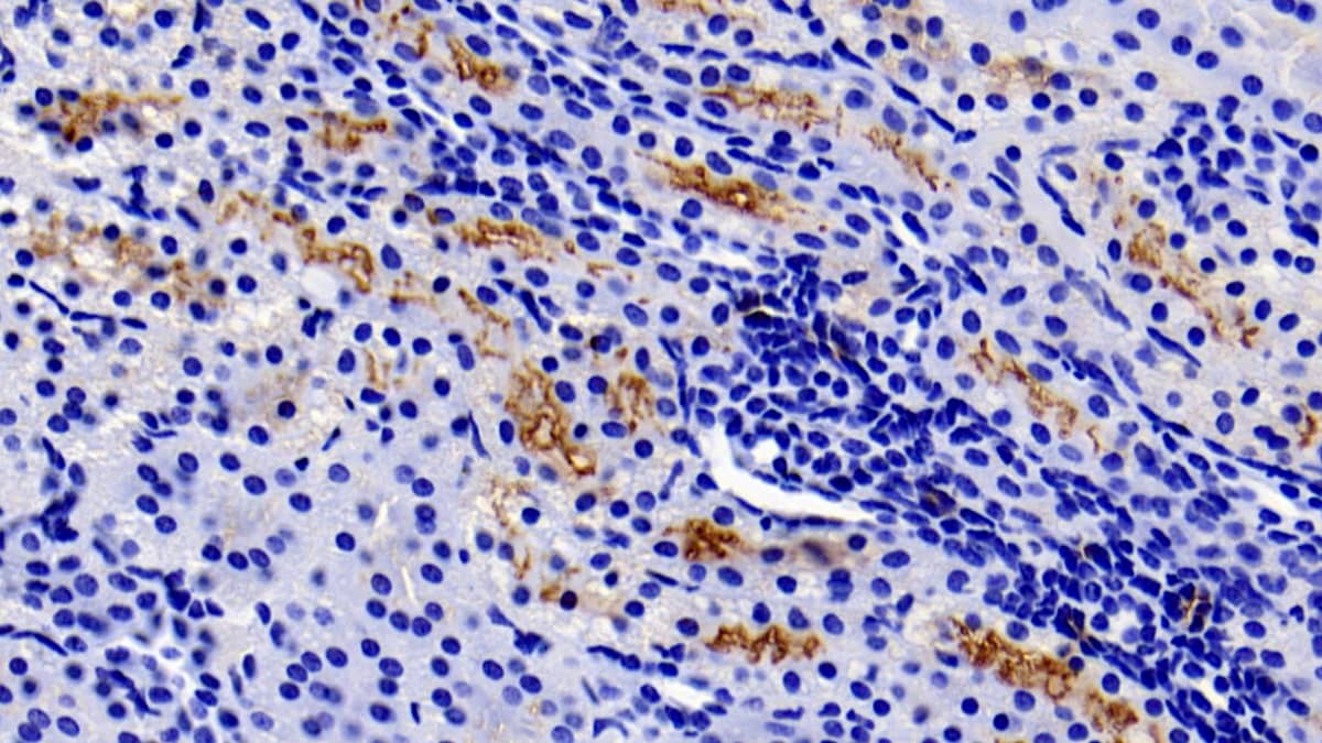 Immunohistochemistry-Paraffin GGT1 Antibody (C1)