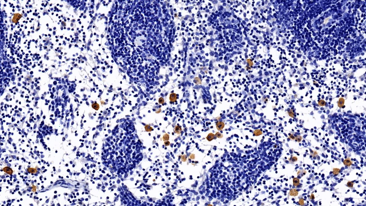 Immunohistochemistry-Paraffin: Bone marrow stromal cell antigen 1/CD157 Antibody (C16) [NBP3-41467] - DAB staining on IHC-P; Sample: Rat Lymph node Tissue; Primary Ab: 20ug/ml NBP3-41467; Second Ab: 2ug/mL HRP-Linked Caprine Anti-Mouse IgG Polyclonal Antibody