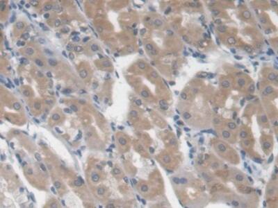 Immunohistochemistry-Paraffin: Galectin-3BP/MAC-2BP/LGALS3BP Antibody (D5) [NBP3-41468] - DAB staining on IHC-P; Samples: Human Stomach Tissue; Primary Ab: 20ug/ml NBP3-41468