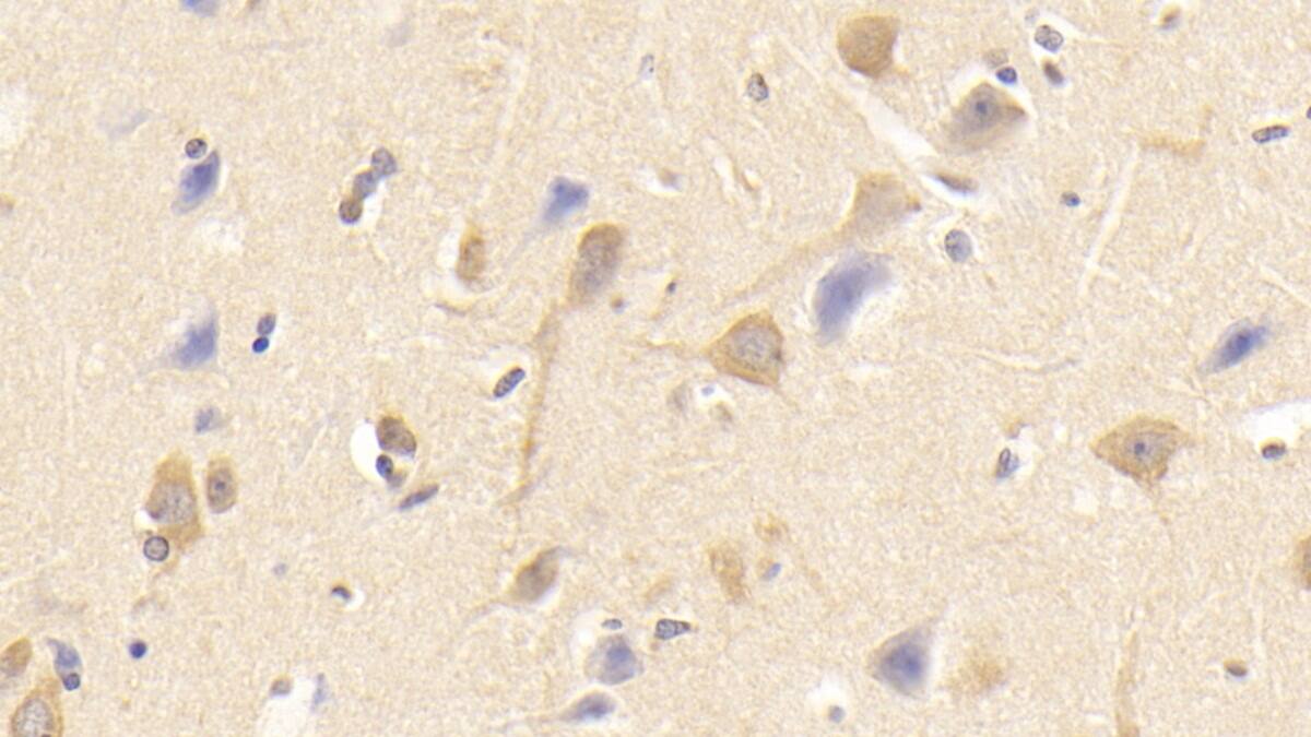 Immunohistochemistry-Paraffin: Siglec-8 Antibody (D3) [NBP3-41469] - DAB staining on IHC-P; Samples: Human Cerebrum Tissue; Primary Ab: 30ug/ml NBP3-41469; Second Ab: 2ug/mL HRP-Linked Caprine Anti-Mouse IgG Polyclonal Antibody