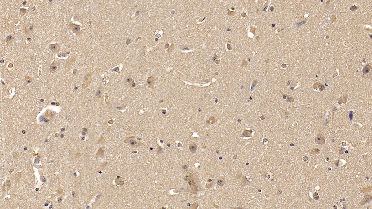 Immunohistochemistry-Paraffin: MMP-25/MT6-MMP Antibody (C6) [NBP3-41470] - DAB staining on IHC-P; Samples: Human Cerebrum Tissue; Primary Ab: 10ug/ml NBP3-41470; Second Ab: 2ug/mL HRP-Linked Caprine Anti-Mouse IgG Polyclonal Antibody