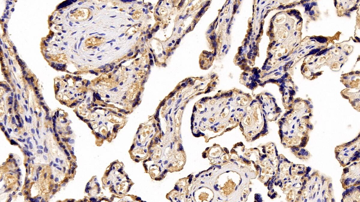 Immunohistochemistry-Paraffin: Placental Lactogen/CSH1 Antibody (C1) [NBP3-41471] - DAB staining on IHC-P; Sample: Human Placenta Tissue; Primary Ab: 20ug/ml NBP3-41471; Second Ab: 2ug/mL HRP-Linked Caprine Anti-Mouse IgG Polyclonal Antibody