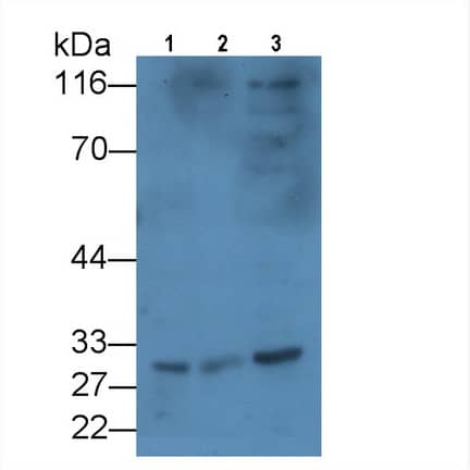 Western Blot: KIR2DS4/CD158i Antibody (C15) [NBP3-41473] - Sample: Lane1: 293T Cell lysate; Lane2: Raji cell lysate; Lane3: Hela cell lysate Primary Ab: 3ug/ml NBP3-41473; Second Ab: 0.2ug/mL HRP-Linked Caprine Anti-Mouse IgG Polyclonal Antibody