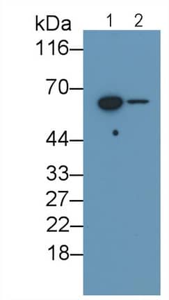Western Blot: IL-10 R beta Antibody (C1) [NBP3-41474] - Sample: Lane1: 293T cell lysate; Lane2: Hela cell lysate Primary Ab: 2ug/ml NBP3-41474; Second Ab: 0.2ug/mL HRP-Linked Caprine Anti-Mouse IgG Polyclonal Antibody