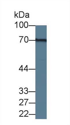 Western Blot: Galectin-3BP/MAC-2BP/LGALS3BP Antibody (D4) [NBP3-41475] - Sample: Rat Stomach lysate; Primary Ab: 3ug/ml NBP3-41475; Second Ab: 0.2ug/mL HRP-Linked Caprine Anti-Mouse IgG Polyclonal Antibody;