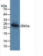 Western Blot: Galectin-3BP/MAC-2BP/LGALS3BP Antibody (D4) [NBP3-41475] - Sample: Recombinant Galectin-3BP/MAC-2BP/LGALS3BP, Human.
