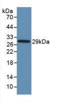 Western Blot: TLR8 Antibody (D2) [NBP3-41476] - Sample: Recombinant TLR8, Human.
