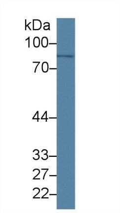 Western Blot: PLA2G4A Antibody (C19) [NBP3-41481] - Sample: Human Lung lysate Primary Ab: 1ug/ml NBP3-41481; Second Ab: 0.2ug/mL HRP-Linked Caprine Anti-Mouse IgG Polyclonal Antibody