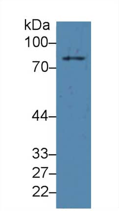 Western Blot: PLA2G4A Antibody (C19) [NBP3-41481] - Sample: Hela cell lysate Primary Ab: 1ug/ml NBP3-41481; Second Ab: 0.2ug/mL HRP-Linked Caprine Anti-Mouse IgG Polyclonal Antibody