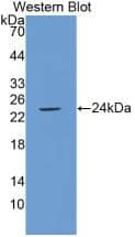 Western Blot: PLA2G4A Antibody (C19) [NBP3-41481] - Sample: Recombinant PLA2G4A, Human.