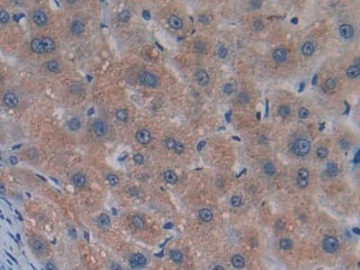 Immunohistochemistry-Paraffin: GDF-8/Myostatin Antibody (A11) [NBP3-41482] - DAB staining on IHC-P; Samples: Human Liver Tissue; Primary Ab: 20ug/ml NBP3-41482; Second Ab: 2ug/mL HRP-Linked Caprine Anti-Mouse IgG Polyclonal Antibody