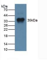 Western Blot: GDF-8/Myostatin Antibody (A11) [NBP3-41482] - Sample: Human Liver Tissue.