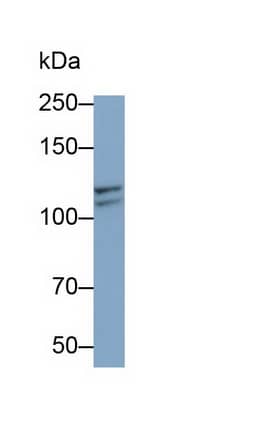 Western Blot: Insulysin/IDE Antibody (C2) [NBP3-41486] - Sample: K562 cell lysate Primary Ab: 0.2ug/ml NBP3-41486; Second Ab: 0.2ug/mL HRP-Linked Caprine Anti-Mouse IgG Polyclonal Antibody