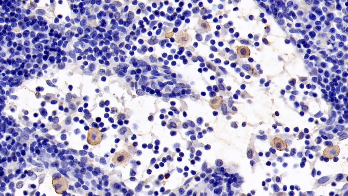 Immunohistochemistry-Paraffin: TLR5 Antibody (8-1#) [NBP3-41489] - DAB staining on IHC-P; Sample: Rat Lymph node Tissue; Primary Ab: 20ug/ml NBP3-41489; Second Ab: 2ug/mL HRP-Linked Caprine Anti-Mouse IgG Polyclonal Antibody