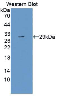 Western Blot: TLR5 Antibody (8-1#) [NBP3-41489] - Sample: Recombinant TLR5, Human.