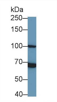 Western Blot: TLR5 Antibody (8-1#) [NBP3-41489] - Sample: Rat Spleen lysate Primary Ab: 0.6ug/ml NBP3-41489; Second Ab: 0.2ug/mL HRP-Linked Caprine Anti-Mouse IgG Polyclonal Antibody