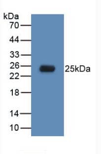 Western Blot: TLR5 Antibody (C6) [NBP3-41490] - Sample: Recombinant TLR5, Human.