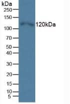 Western Blot: TLR5 Antibody (C6) [NBP3-41490] - Sample: Human Hela Cells.