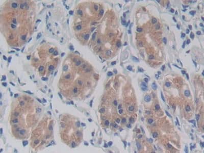 Immunohistochemistry-Paraffin: TLR5 Antibody (C6) [NBP3-41490] - DAB staining on IHC-P; Samples: Human Stomach Tissue; Primary Ab: 20ug/ml NBP3-41490; Second Ab: 2ug/mL HRP-Linked Caprine Anti-Mouse IgG Polyclonal Antibody