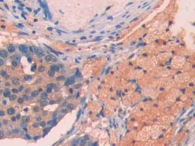 Immunohistochemistry-Paraffin: Apolipoprotein A5 Antibody (C11) [NBP3-41491] - DAB staining on IHC-P; Samples: Human Lung Tissue; Primary Ab: 30ug/ml NBP3-41491