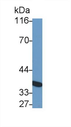 Western Blot: IL-10 R beta Antibody (C9) [NBP3-41496] - Sample: 3T3-L1 cell lysate Primary Ab: 1.5ug/ml NBP3-41496; Second Ab: 0.2ug/mL HRP-Linked Caprine Anti-Mouse IgG Polyclonal Antibody