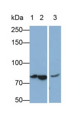 Western Blot: Complement C4b Antibody (D1) [NBP3-41497] - Sample: Lane1: Human Serum; Lane2: Human Plasma; Lane3: Human Placenta lysate Primary Ab: 0.05ug/ml NBP3-41497; Second Ab: 0.2ug/mL HRP-Linked Caprine Anti-Mouse IgG Polyclonal Antibody