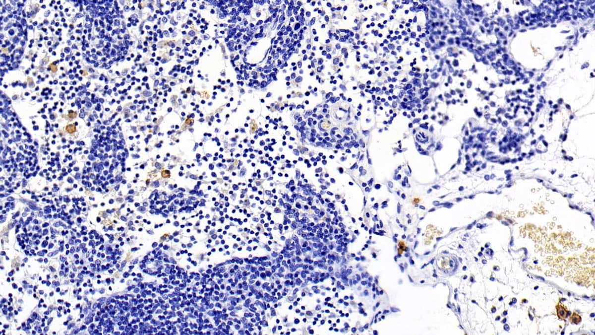 Immunohistochemistry-Paraffin: TLR5 Antibody (C8) [NBP3-41500] - DAB staining on IHC-P; Sample: Rat Lymph node Tissue; Primary Ab: 30ug/ml NBP3-41500; Second Ab: 2ug/mL HRP-Linked Caprine Anti-Mouse IgG Polyclonal Antibody