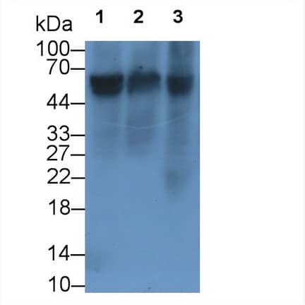 Western Blot: Reduced Folate Carrier/SLC19A1 Antibody (C5) [NBP3-41501] - Sample: Lane1: Rat Cerebrum lysate; Lane2: Rat Cerebellum lysate; Lane3: Rat Uterus lysate Primary Ab: 2ug/ml NBP3-41501; Second Ab: 0.2ug/mL HRP-Linked Caprine Anti-Mouse IgG Polyclonal Antibody