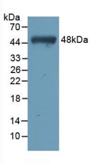 Western Blot: Troponin C (cardiac) Antibody (C5) [NBP3-41504] - Sample: Recombinant Troponin C (cardiac), Human.