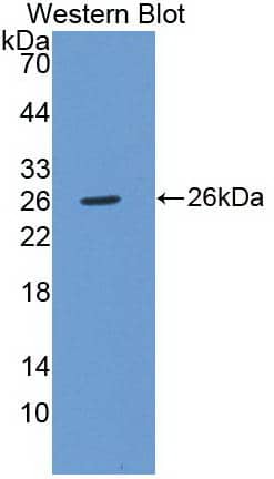 Western Blot: ATN1 Antibody (C1) [NBP3-41505] - Sample: Recombinant ATN1, Human.